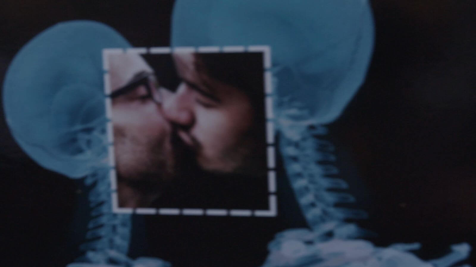 Close up x-ray image of two people kissing